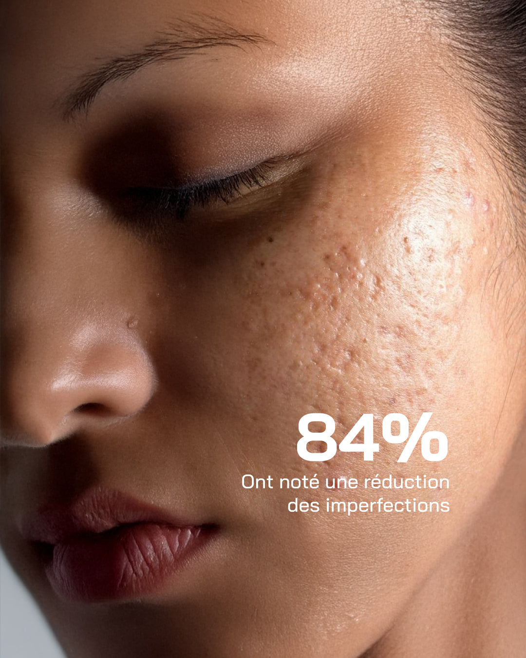 Acide Hyaluronique + Niacinamide [ Peaux Sensibles ] - Touché Skincare Lab