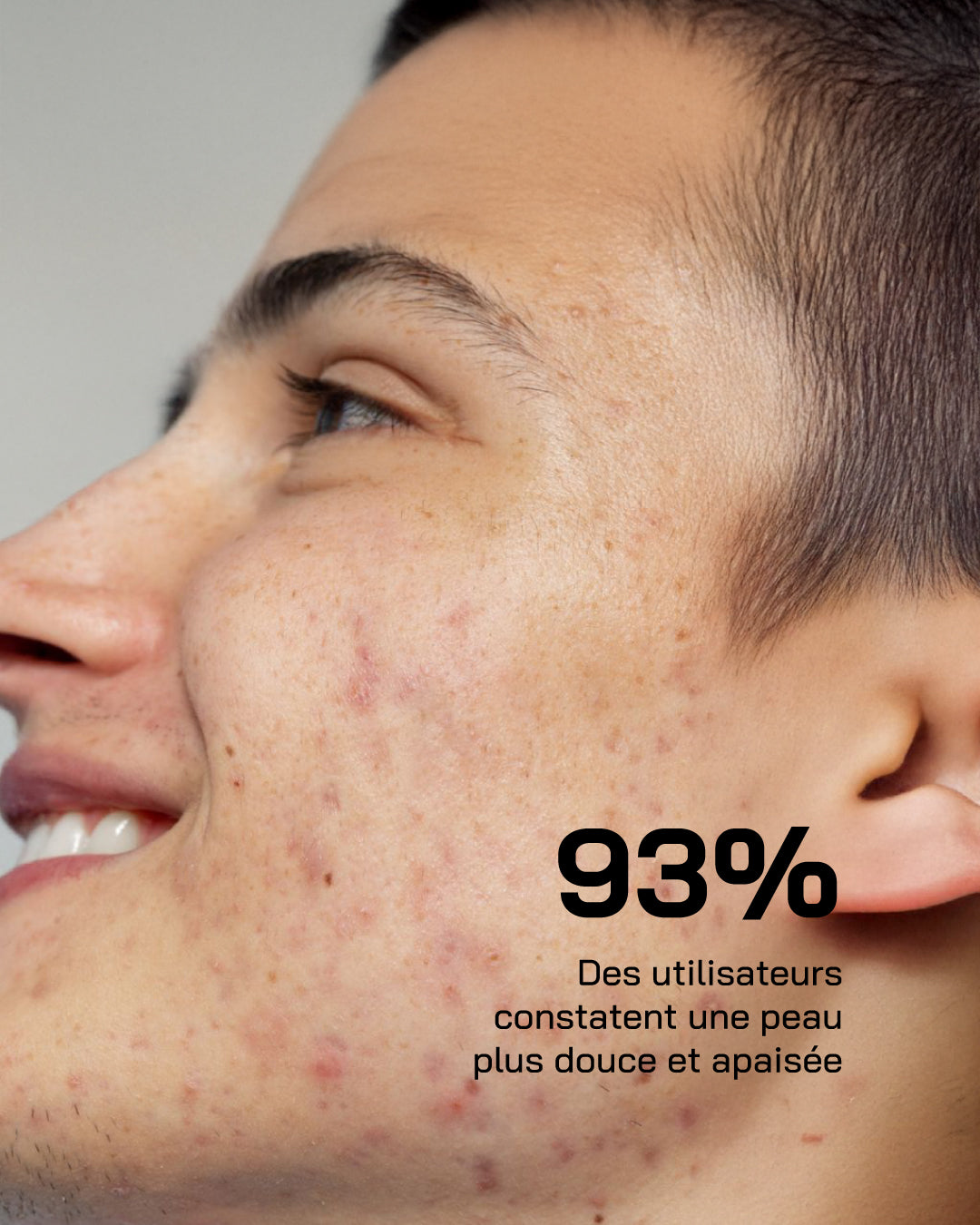 Acide Hyaluronique + Niacinamide [ Peaux Sensibles ] - Touché Skincare Lab