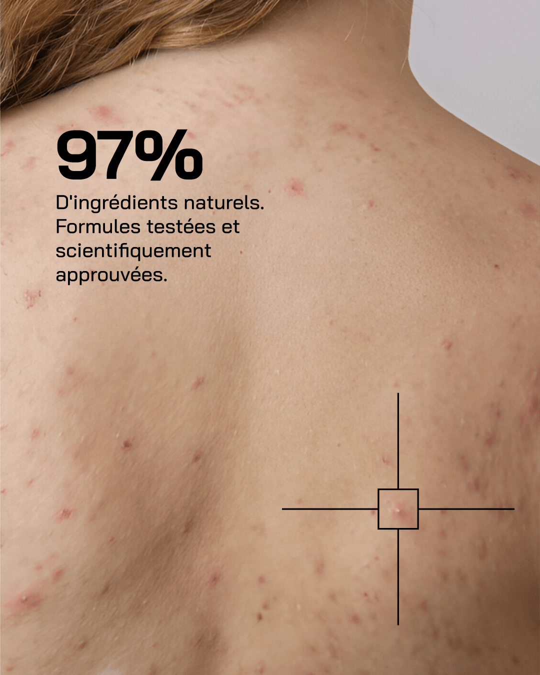 Gel Douche nettoyant Anti-Imperfections - Touché Skincare Lab