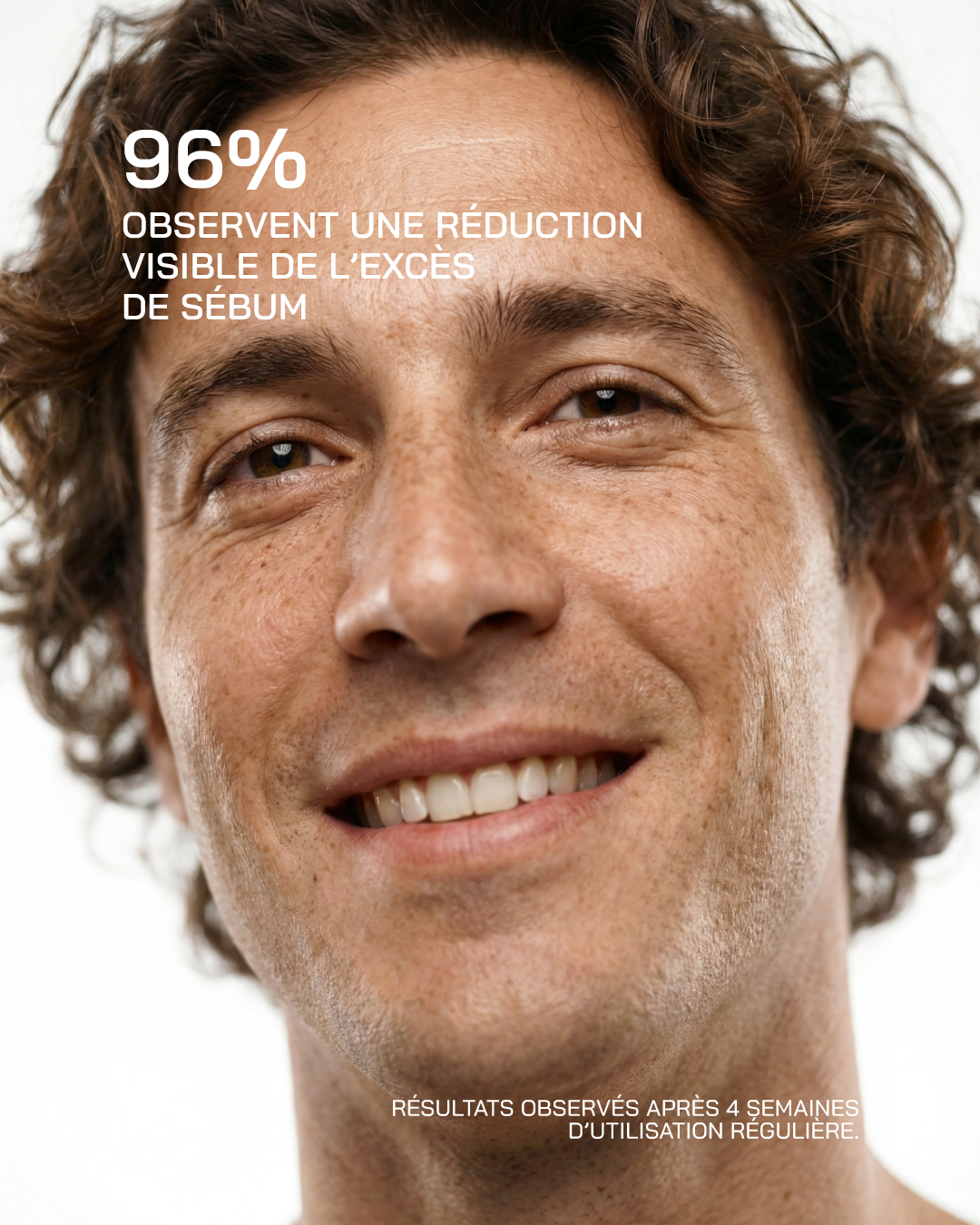 Niacinamide 12% – ULTRA PURE · HIGH POTENCY - Touché Skincare Lab