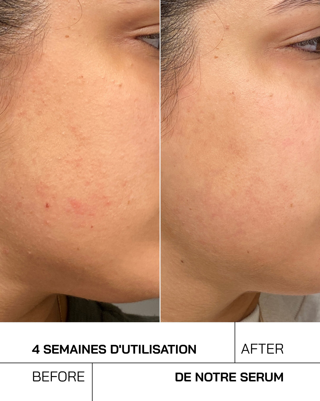 Acide Hyaluronique + Niacinamide [ Peaux Sensibles ] - Touché Skincare Lab