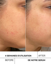 Acide Hyaluronique + Niacinamide [ Peaux Sensibles ] - Touché Skincare Lab