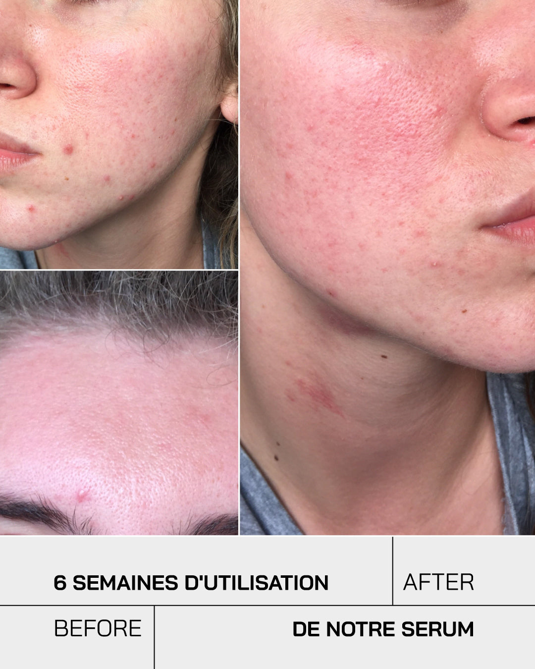 Acide Hyaluronique + Niacinamide [ Peaux Sensibles ] - Touché Skincare Lab