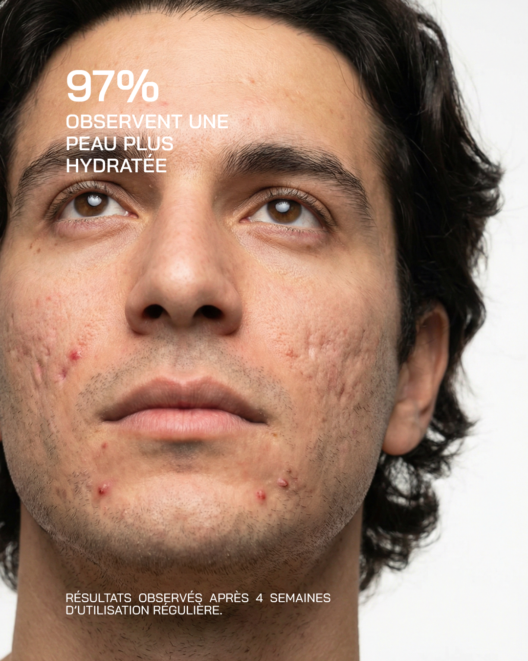 ACIDE HYALURONIQUE + NIACINAMIDE ULTRA PURE · HIGH POTENCY [Peaux sensibles] - Touché Skincare Lab