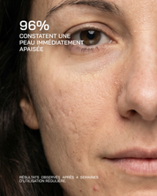 ACIDE HYALURONIQUE + NIACINAMIDE ULTRA PURE · HIGH POTENCY [Peaux sensibles] - Touché Skincare Lab