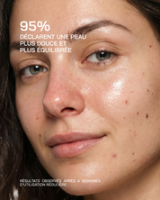 ACIDE HYALURONIQUE + NIACINAMIDE ULTRA PURE · HIGH POTENCY [Peaux sensibles] - Touché Skincare Lab