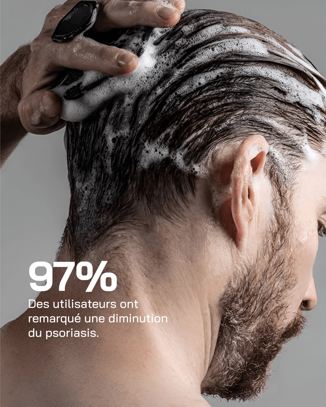 Shampoing Anti-Psoriasis - Touché Skincare Lab