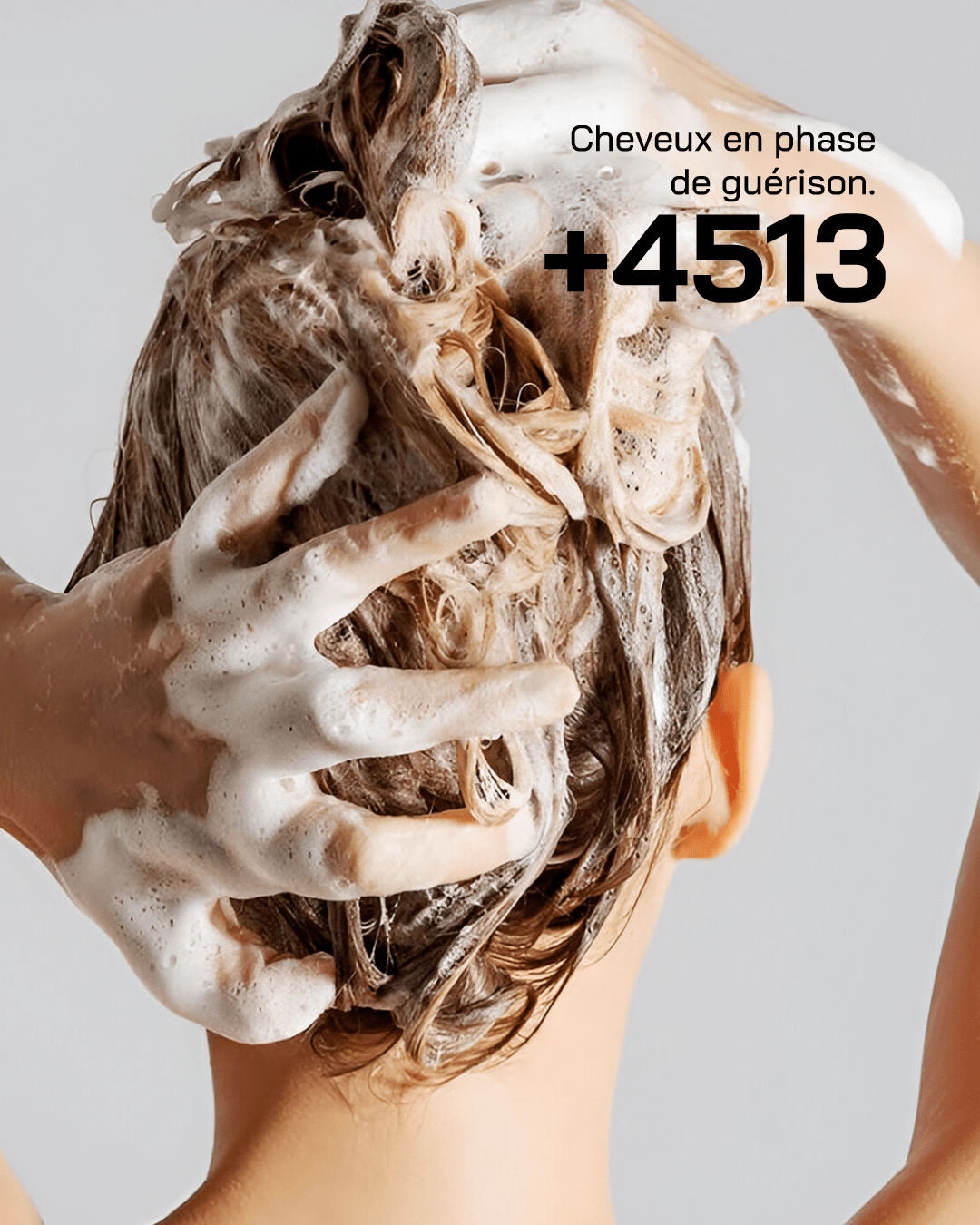 Shampoing Anti-Psoriasis - Touché Skincare Lab