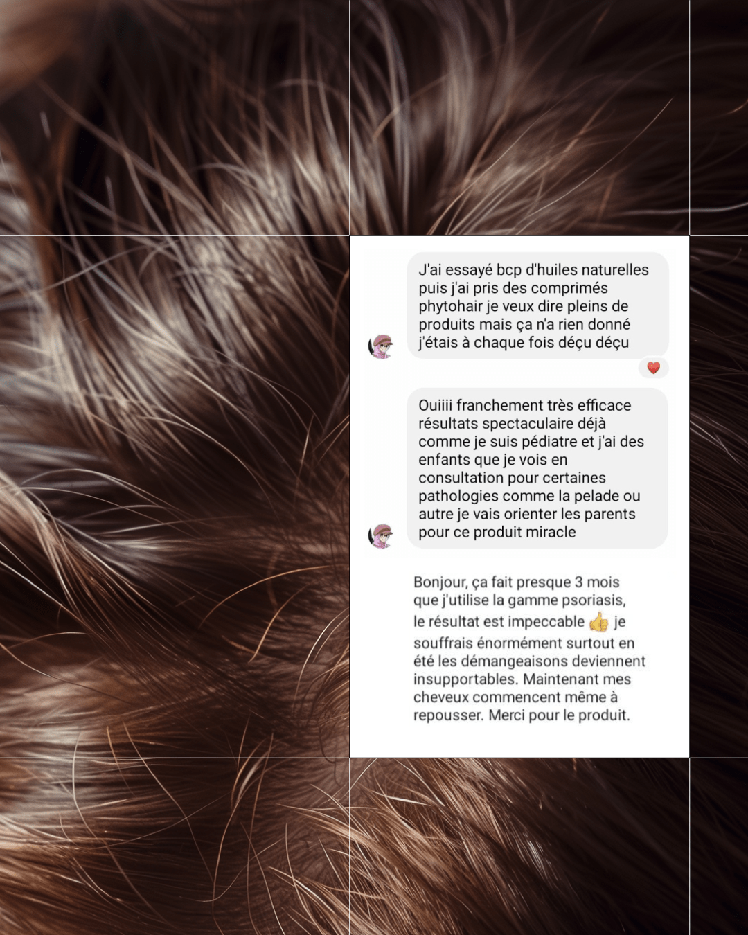 Shampoing Anti-Psoriasis - Touché Skincare Lab