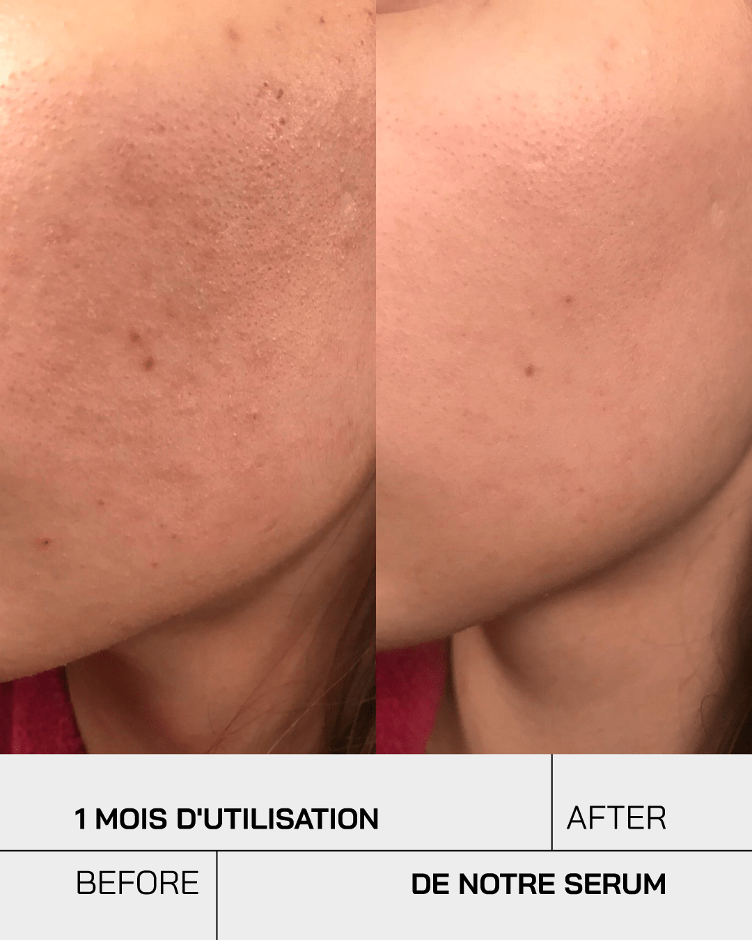 Acide Salicylique - Touché Skincare Lab