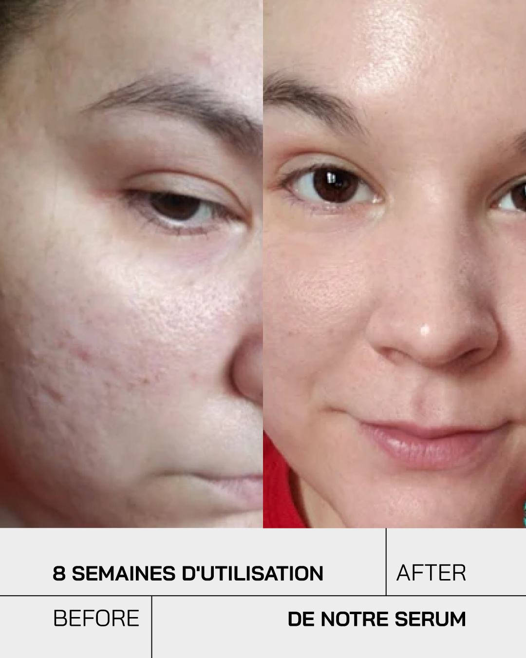 Sérum Niacinamide 10% + Zinc 1% - Touché Skincare Lab