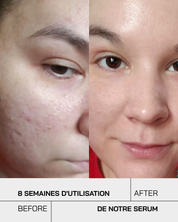 Sérum Niacinamide 10% + Zinc 1% - Touché Skincare Lab