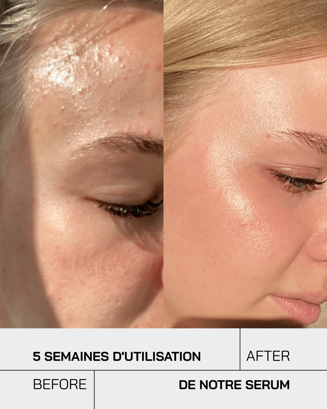 Sérum Niacinamide 10% + Zinc 1% - Touché Skincare Lab