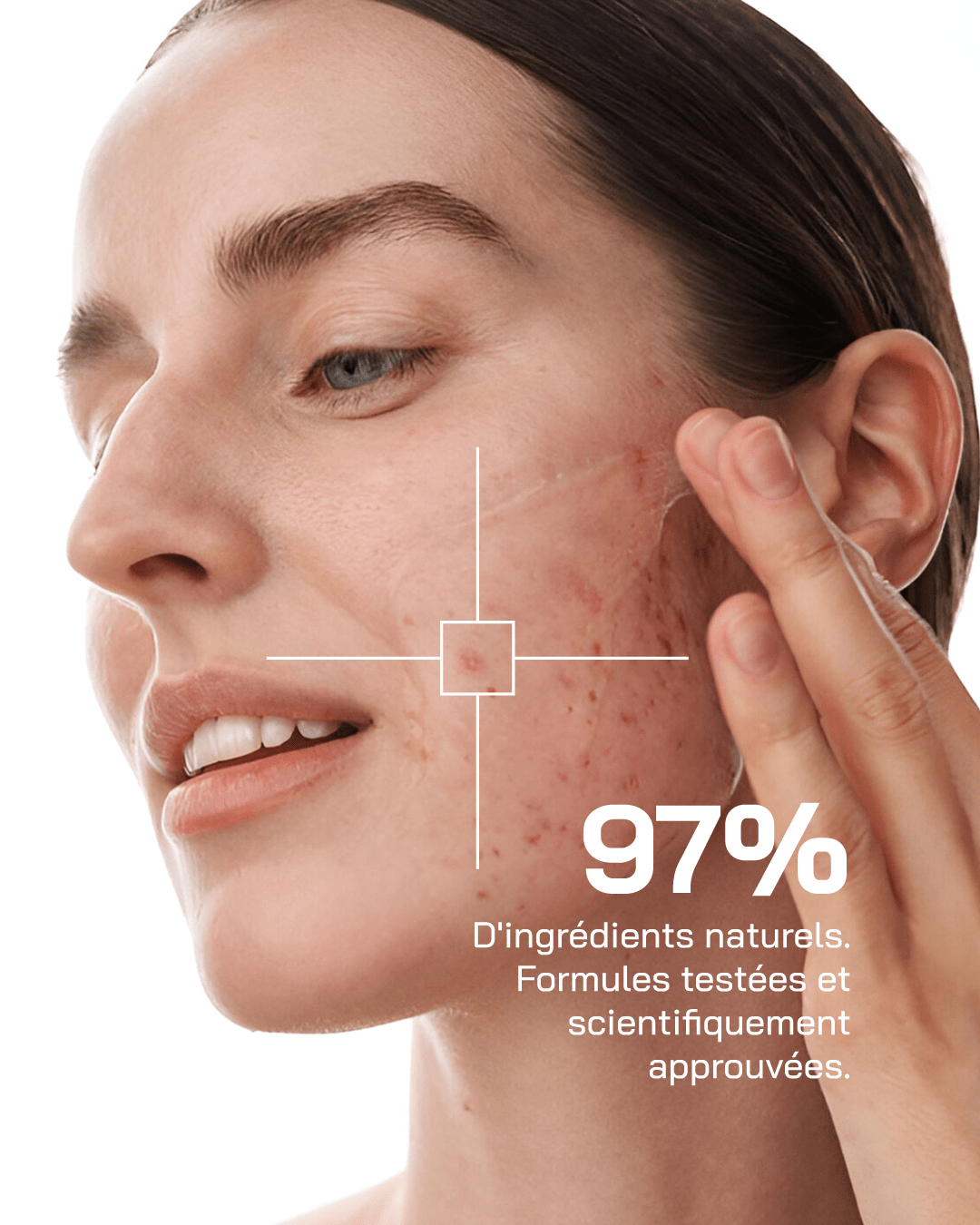Sérum Niacinamide 10% + Zinc 1% - Touché Skincare Lab