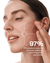 Sérum Niacinamide 10% + Zinc 1% - Touché Skincare Lab