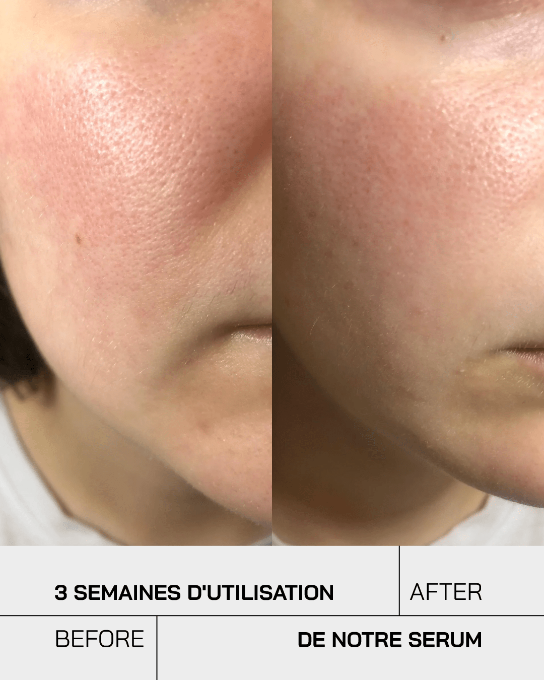 Sérum Niacinamide 10% + Zinc 1% - Touché Skincare Lab