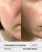 Sérum Niacinamide 10% + Zinc 1% - Touché Skincare Lab