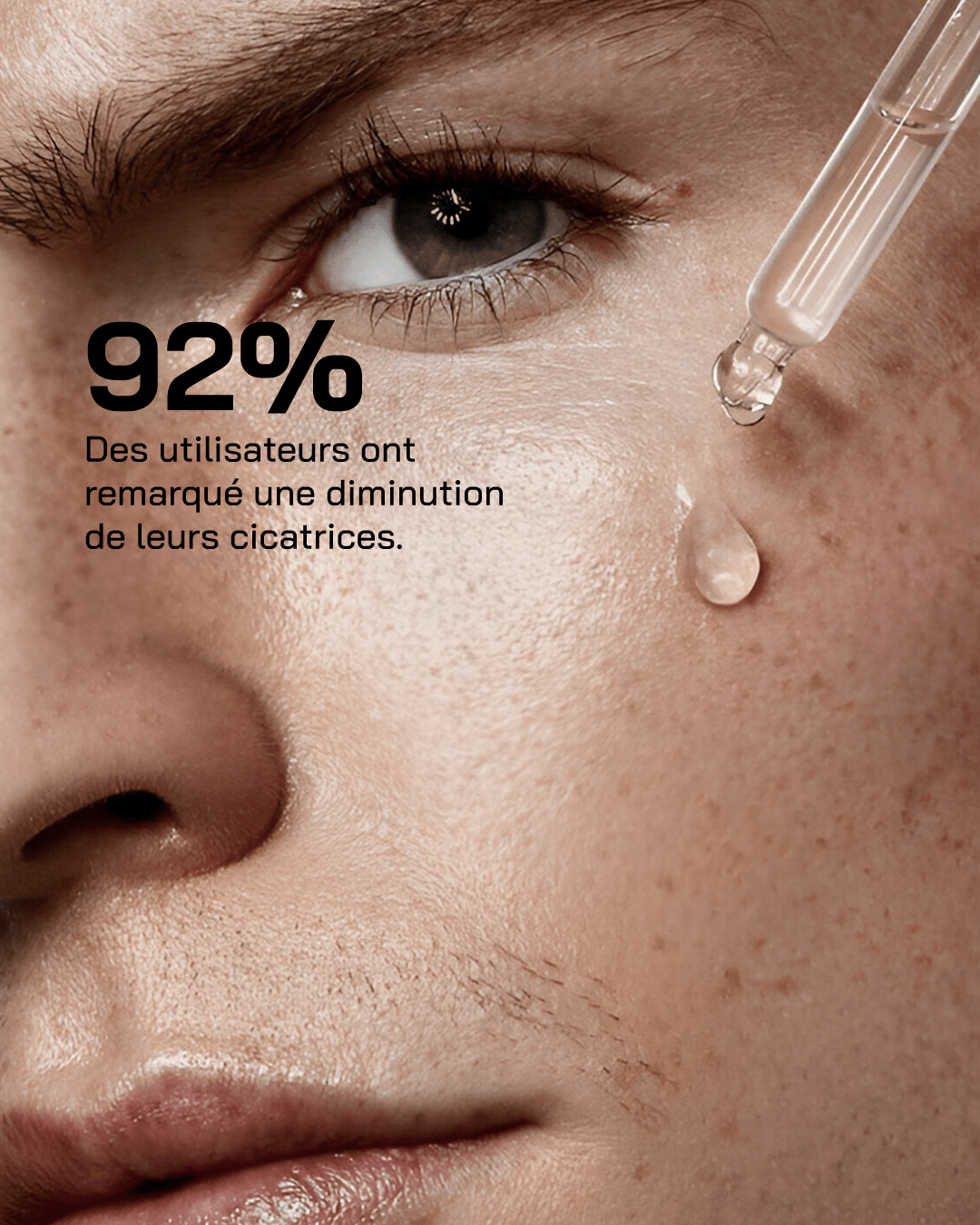 Sérum Niacinamide 10% + Zinc 1% - Touché Skincare Lab