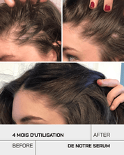 Anti Chute - Touché Skincare Lab