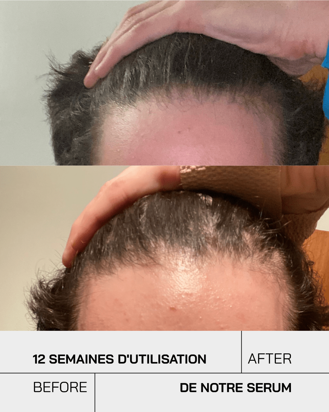 Anti Chute - Touché Skincare Lab