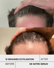 Anti Chute - Touché Skincare Lab