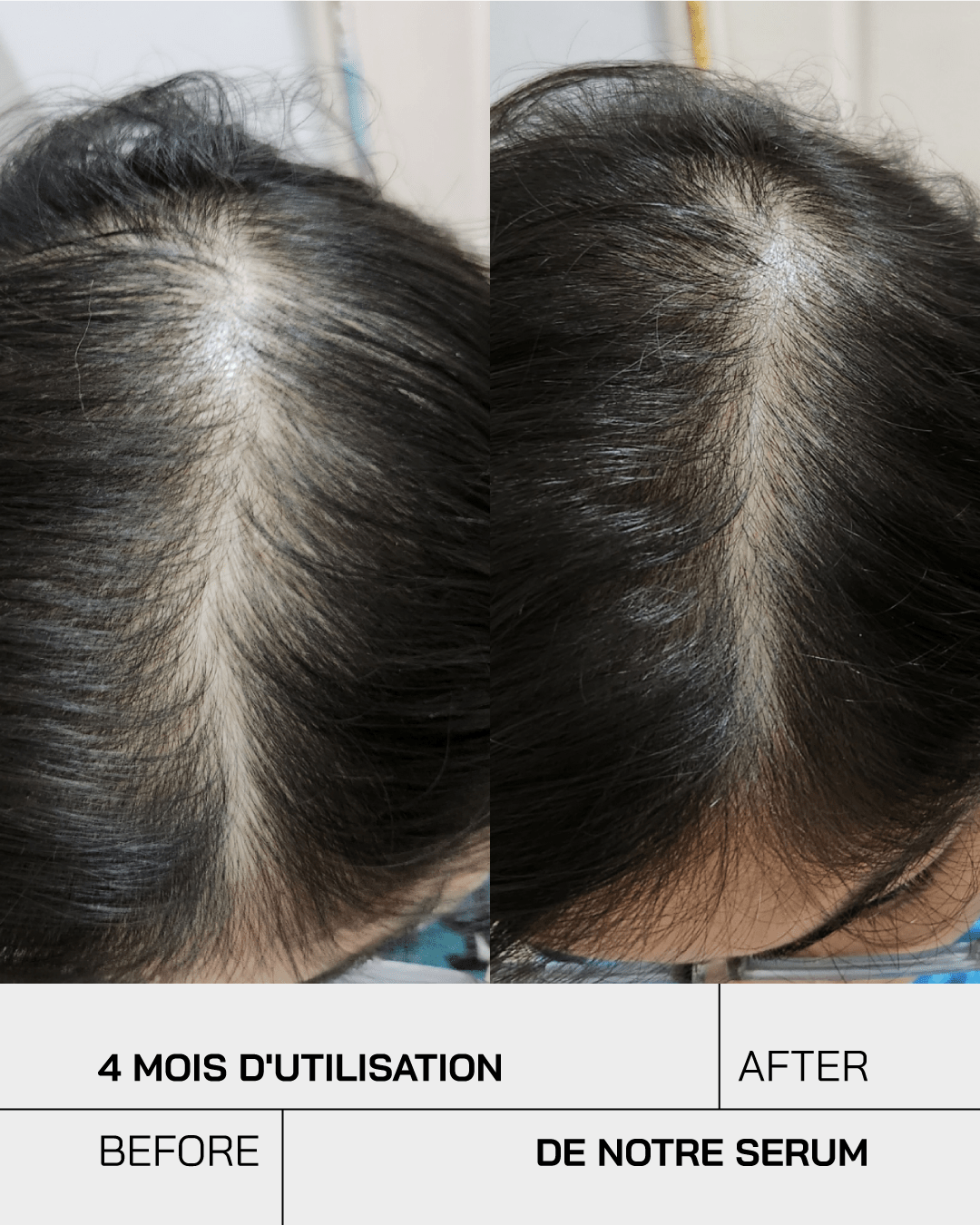 Anti Chute - Touché Skincare Lab