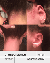 Anti-Irritations - Touché Skincare Lab