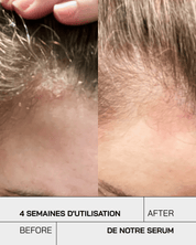 Anti-Irritations - Touché Skincare Lab