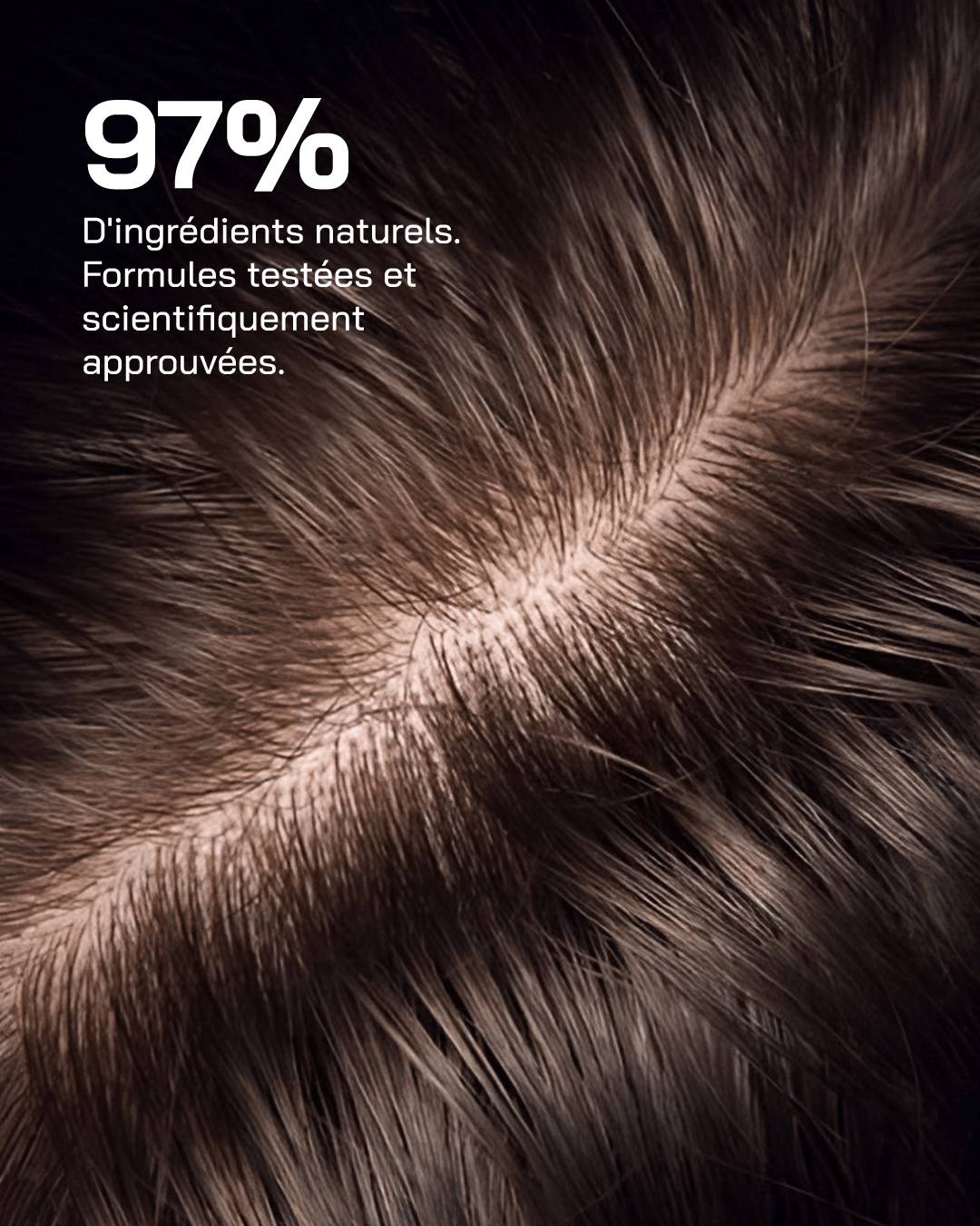 Anti-Irritations - Touché Skincare Lab