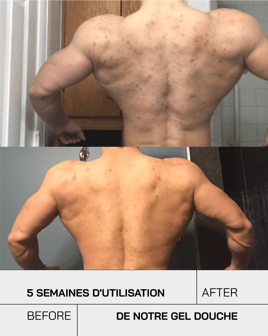 Gel Douche nettoyant Anti-Imperfections - Touché Skincare Lab