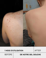Gel Douche nettoyant Anti-Imperfections - Touché Skincare Lab