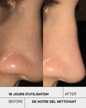 Gel Nettoyant Purifiant Visage - Touché Skincare Lab