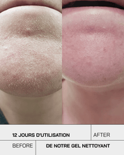 Gel Nettoyant Purifiant Visage - Touché Skincare Lab