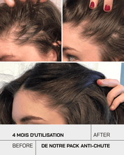 Pack Anti Chute Touché - Touché Skincare Lab