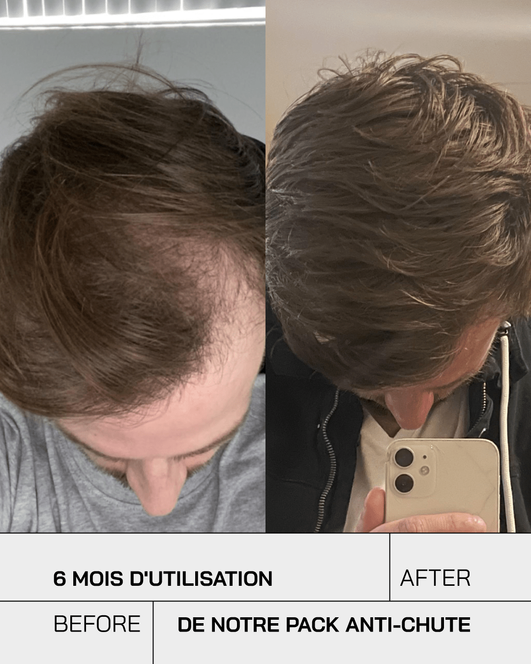 Pack Anti Chute Touché - Touché Skincare Lab