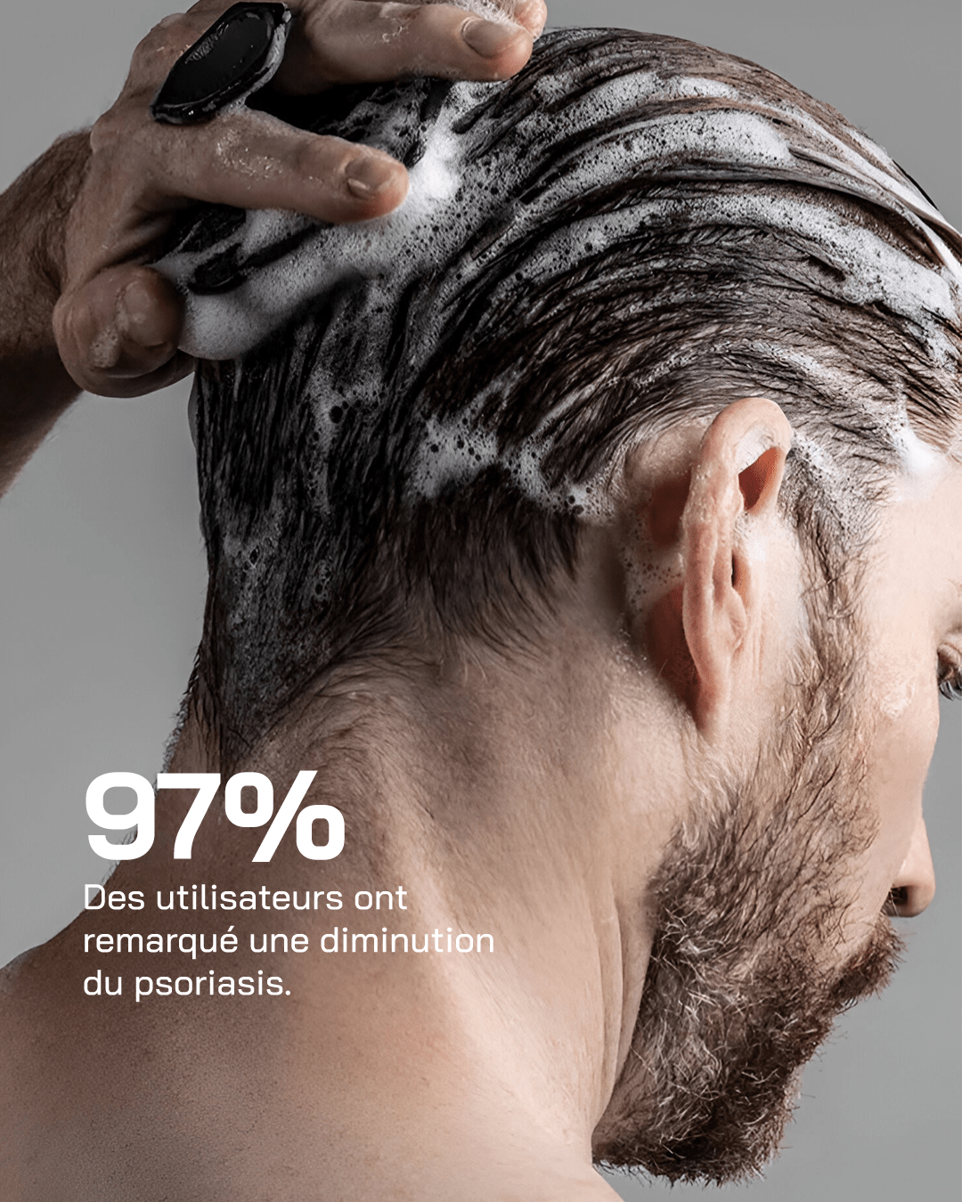 Routine Psoriasis Control - Touché Skincare Lab