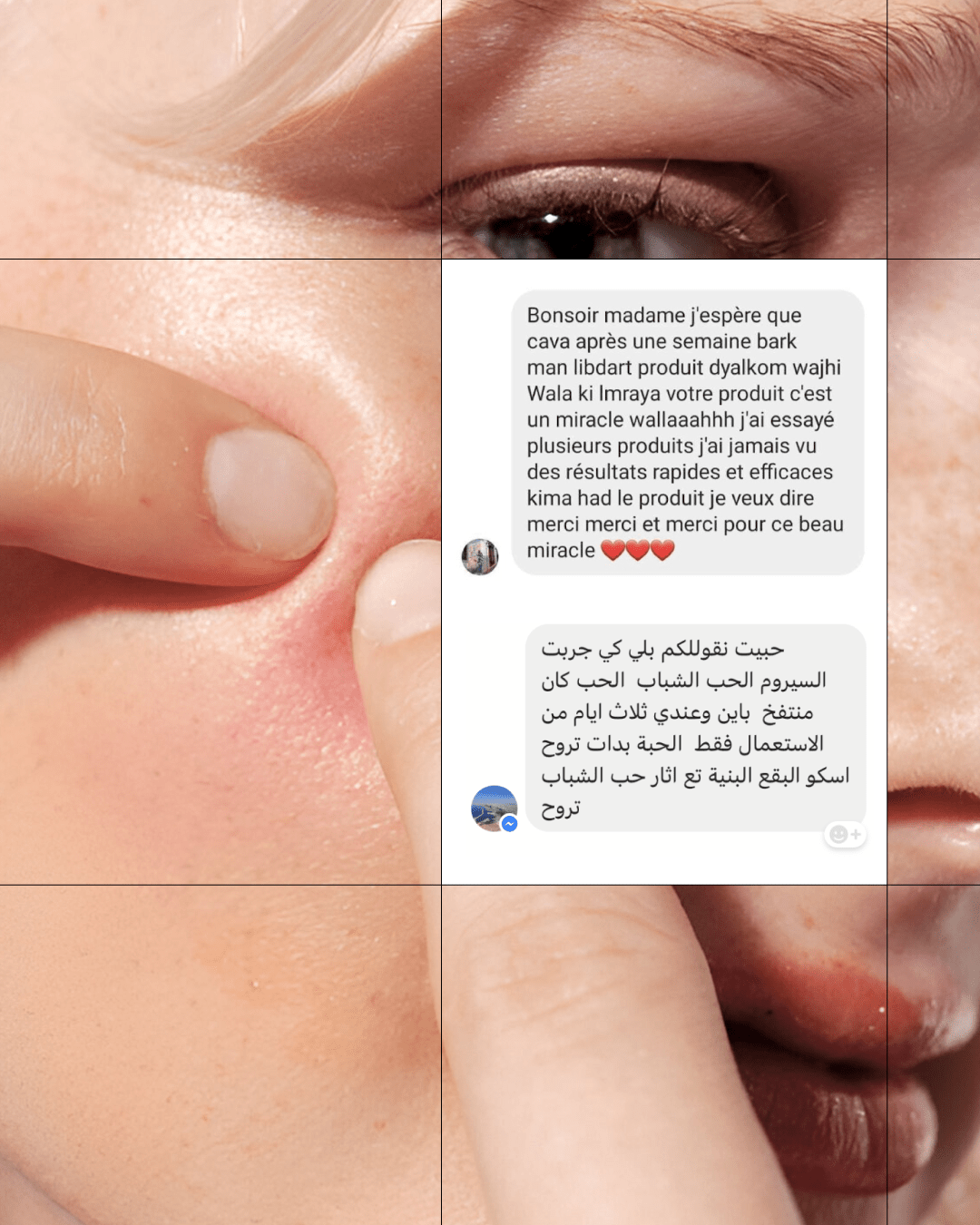 Anti Acné - Touché Skincare Lab