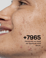 Anti Acné - Touché Skincare Lab