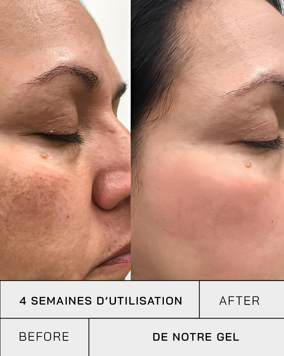 Gel Vitamine C 11% + SPF 30 - Touché Skincare Lab