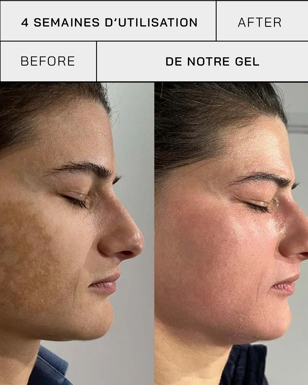 Gel Vitamine C 11% + SPF 30 - Touché Skincare Lab