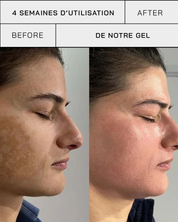 Gel Vitamine C 11% + SPF 30 - Touché Skincare Lab