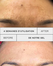 Gel Vitamine C 11% + SPF 30 - Touché Skincare Lab